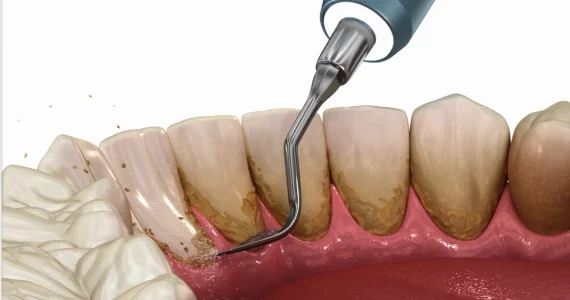 Screen Shot 2022-10-01 at 5.39.55 PM